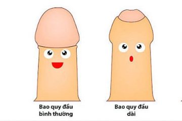 Dài bao quy đầu: Dấu hiệu, nguyên nhân và cách điều trị