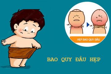 Hẹp bao quy đầu là gì? Tổng quan hẹp bao quy đầu