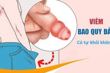 Viêm bao quy đầu có tự khỏi không? Giải đáp chi tiết từ chuyên gia