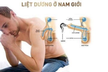 Liệt dương có nguy hiểm không? 4+ Nguy hại khôn lường cần chú ý