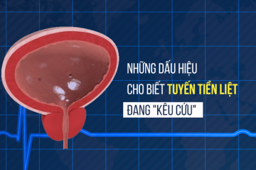 [Cảnh báo] 8+ Dấu hiệu viêm tuyến tiền liệt ở nam giới