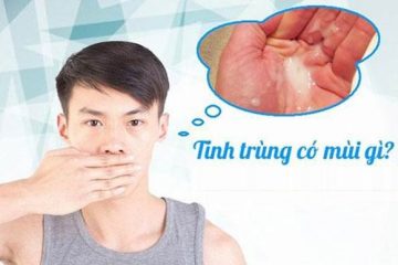 Tinh trùng có mùi gì? Những yếu tố ảnh hưởng đến mùi tinh trùng