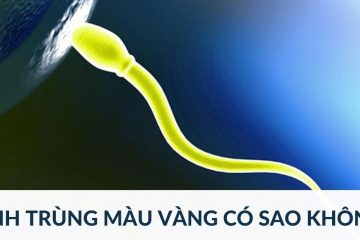 Điểm mặt 7+ nguyên nhân tinh trùng màu vàng thường gặp