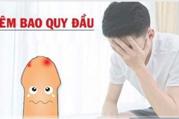 [ Chuyên gia y tế chia sẻ] Viêm bao quy đầu gây nên những tác hại gì?