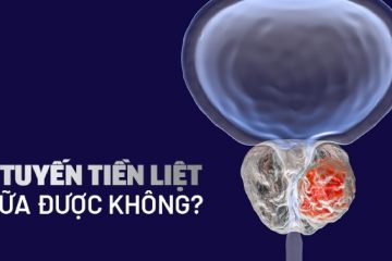 Viêm tuyến tiền liệt có chữa được không? Câu trả lời sẽ có trong bài viết