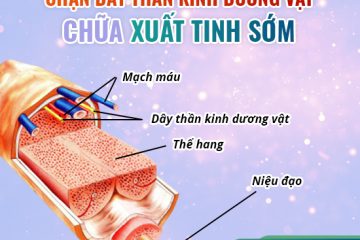 Phương pháp chữa xuất tinh sớm của bác sĩ Hương – Đa khoa Quốc tế Việt khang