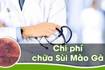 Chi phí hỗ trợ điều trị bệnh sùi mào gà bao nhiêu tiền?