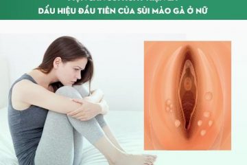 Dấu hiệu sùi mào gà ở nữ qua 5 giai đoạn phát triển [Kèm hình ảnh chi tiết]